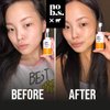 No B.S. (No Bad Stuff) Skincare Minis Kit, Vitamin C & E Serum with Hyaluronic Acid, Retinol Night Cream, Caffeine Eye Cream, Waterproof Acne Patches, 4 Product Trial Size Skin Care, Gluten Free
