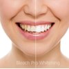 Teeth Whitening Gel Syringe Dispensers 35% Carbamide Peroxide Tooth Bleaching 20 Dispensers 3ml