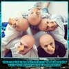 Yunlly 18 Pack Halloween Bald Caps Set Makeup Latex Bald Head Wig Cap Long Fake Nose for Adults Costume Accessories(Classic)
