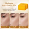LOYATRO Turmeric Kojic Acid Dark Spot Remover Soap Bars with Vitamin C, Retinol, Collagen - Original Japanese Complex Infused with Hyaluronic Acid, Vitamin E, Shea Butter