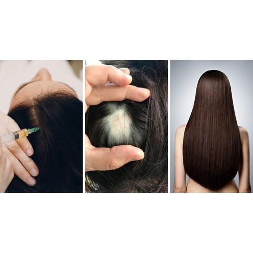 Olep Hair-Growth ONNION Oil- 4 oz100% Organic- Grow Girl! Serum-Vegan Scalp,Strengthening Oil, calp-Aceite capilar, Tratamiento capila (4 ONZAS, ONNION OIL)