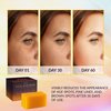 VALITIC Kojic Acid Soap for Hyperpigmentation - with Glutathione, Collagen & Vitamin C - Natural Soap Bars with Turmeric - Original Japanese Complex for Dark Spot Correction - 2 Pack + Holder