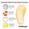 SkinIntegra Rapid Crack Repair Cream, Extra Strength Urea Cream 25% with Lactic Acid for Cracked Heel Treatment, Diabetic Foot Care, Callus Remover, Scars, Skin Barrier Repair - 3 oz