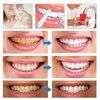 3Pcs LANTHOME Teeth Whitening Essence, Teeth Stain Remover to,Purely White Deluxe Teeth Whitening Kit Pen.