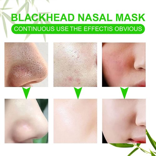 AGETITY Nose Strips for Blackheads, Pore Strips Blackhead Remover for Face, Nose Blackhead Remover Strip, Nose Pore Strips Black Head Remover for Women Men (80)