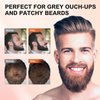 Acosexy Root Touch Up Hair Powder, Instantly Root Cover Up Hairline Shadow Powder,Black Hairline Powder for Women Eyebrows, Touch Up Hair Powder For Men Beard Line,Bald Spots (Black)