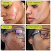 Gleamin Vitamin C Treatment Clay Mask - Turmeric Clay Face Mask Skin Care, Deep Cleansing Pores - Facial Improves Uneven Tone, Post-Blemish, Visibly Brighten, Scarring and Texture - 2.5 Oz