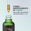 Alra Olive Therapy Serum for Face, Acne Treatment for Face with 22% Olive Extracts, Face Serum Reduces Redness & Anti-Acne, Skincare Gifts for Women/Men in Oily & Acne-Prone Skin, 0.5 fl oz/15ml