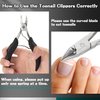 JTIEO 4 Pack Ingrown Toenail Clippers Kit for Ingrown & Thick Nail Ingrown Toenail Treatment Ingrown Toenail Removal Kit Professional Tool