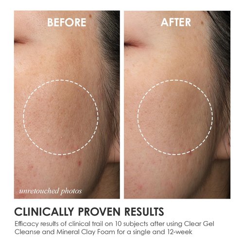 Fleuri - Mineral Clay Foam - Gentle Face Cleanser, Face Wash, Daily Facial Cleanser for Sensitive Skin, Moisturizing Face Wash for Normal to Dry Skin, Made in Japan, 3.5 fl oz, 100g