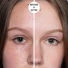 Just Nutritive Acne Clear Face and Body Wash | Adult Acne Treatment | Acne Face Wash | Face Skin Care | Back Acne Treatment | Acne Cleansers 16 Oz