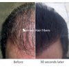 Samson Hair Fibers for Thinning Hair - 100% Undetectable Natural Formula - Completely Conceals Hair Loss in Seconds. Covers bald spots. Thicken your hair instantly - 25 Grams Refill (DARK GRAY)