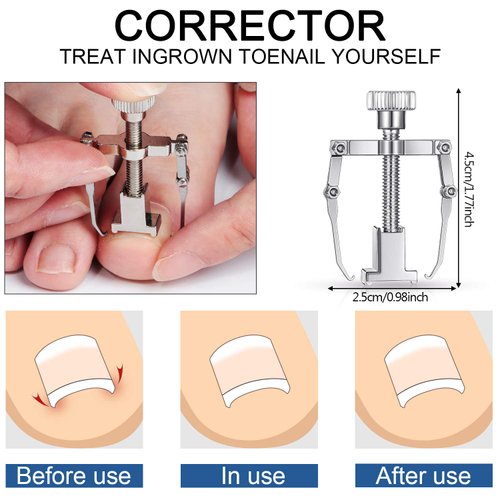 15 Pieces Ingrown Toenail Tools Stainless Steel Foot Nail Tools, Toenail File and Lifter, Nail Clipper, Cuticle Cutters, Cuticle Pusher and Manicure Pedicure Tools for Ingrown and Thick Nail (Black)