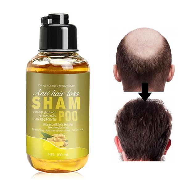 Rosarden Ginger Shampoo, Ginger Shampoo For Hair, Ginger Hair Shampoo For Men and Women, Ginger Shampoo For Nourishing and Smoothing hair - 100ml