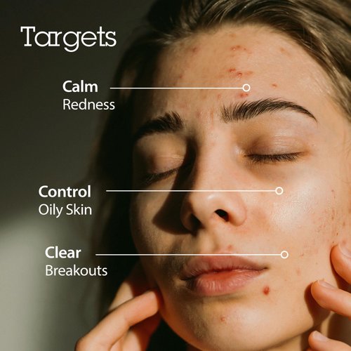 BLITHE Korean Skin Care Products 6 Leaves Clear Essence for Rosacea & Redness Relief, BHA Toner Cooling Moisturizer for Face, Blackhead Treatment, Evening Primrose Wintergreen Green Tea 1.83 Oz