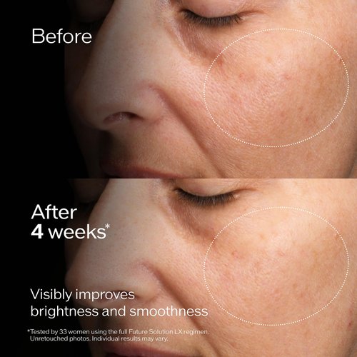 Shiseido Future Solution LX Concentrated Brightening Softener - 170 mL - Anti-Aging Facial Lotion - Smooths & Clarifies Skin - All Skin Types - Non-Comedogenic