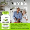 Viteyes AREDS 2 Eye Vitamins, Classic Macular Support, Allergen Free Capsules, with Natural Vitamin E, Vitamin C, Zinc, Copper, Lutein & Zeaxanthin, Eye Doctor Trusted, Manufactured in The USA, 180 Ct