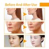 Turmeric Face Cream, Anti-Aging Facial Cream, Turmeric Face Cream with Vitamin C for Hydrating, Firming, Tightening Skin, Natural Turmeric Face Repair Cream for Normal, Dry, Oily & Combination Skin