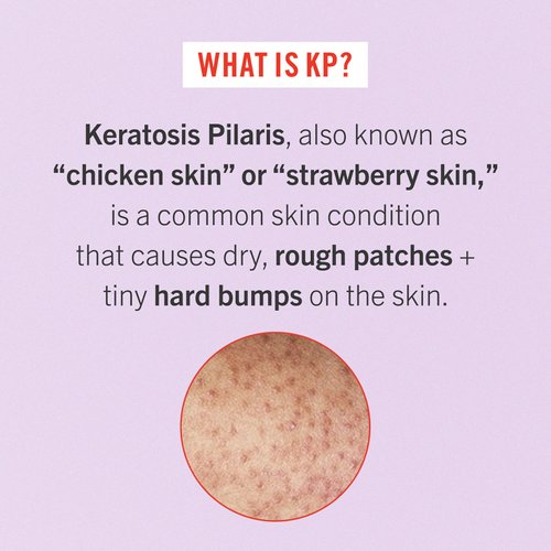 First Aid Beauty Smooth Operators Trio – 3 Exfoliating Favorites – KP Bump Eraser Body Scrub with10% AHA, 8 oz, KP Smoothing Body Lotion, 6 oz, & Ingrown Hair Pads, 28 Count