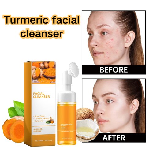 EIVJEC 2Pcs Turmeric Facial Cleanser, Foaming Face Wash, Turmeric Face Wash, Turmeric Acid Foaming Cleanser,Turmeric Facial Wash