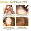 2PC Veganic Natural Hair Growth Oil, veganic hair growth oil Rosemary Oil for Hair Growth Organic,veganic hair oil for dry damaged hair and growth (60ml *2PC)