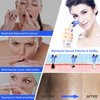 Blackhead Remover Pore Vacuum, Face Suction Pore Cleaner, 5 Suction Power Electric Blackhead Suction Remover, Extractor Tool, 4 Probes for Women & Men (Blue）