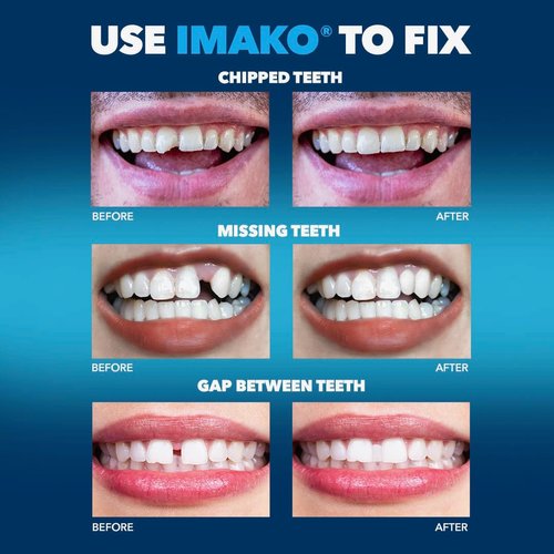 Imako Tooth Tinted Plastic - Natural Color - Temporary Tooth - Made in USA