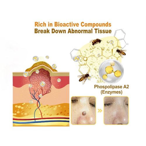 Turonu Bee Venom Cream, Professional Bee Venom Skin Treatment Cream, Professional bee venom Correcting cream for All Skin Types (1 Bottle)