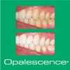 Opalescence Teeth Whitening Toothpaste (Pack of 2) - Cool Mint Original Formula - Oral Care, Gluten-Free - 4.7 Ounce Made by Ultradent.- TP-5166-2