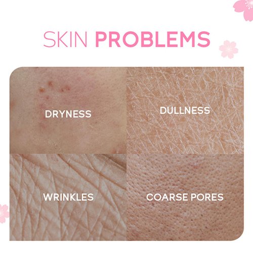 Sakura Skin Care Set, Sakura Skincare Kit For Teenage Girls, Skin Care Kit With Cleanser,Toner,Eye Cream,Face Cream,Serum, Sleep Mask*2, Travel Skincare Set, Skincare Gift Set For Her