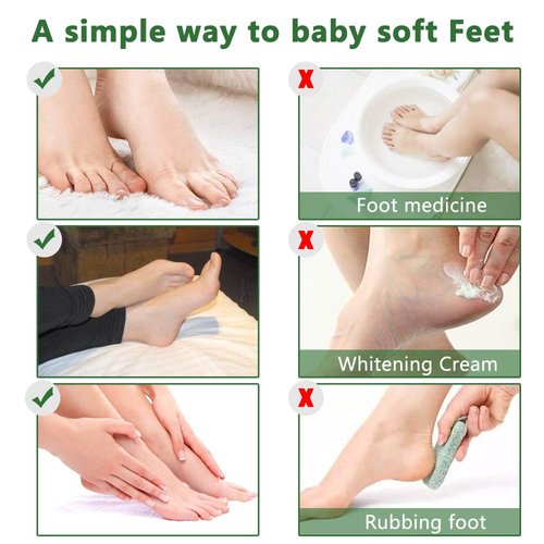 Foot Peel Mask - 5Pack, Exfoliating Foot Care Mask Make Soft Baby Feet Peel, Foot Exfoliator Repair Dead Skin, Calluses, Chapped, Rough Feet (Tea Tree)