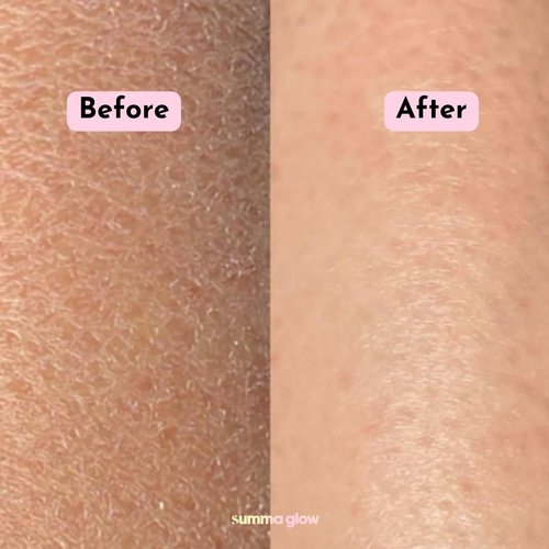 Summa Glow Deep Exfoliating Body Scrubber Mitt Exfoliating Body Scrubber Glove Exfoliator Body Scrub For Removing Dry Skin, Tan Remover, Illuminating Gloves For Skin, Shower Glove, Strawberry Skin