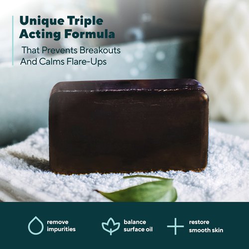 Marie Originals Acne Bar Soap Cleanser for Face and Body