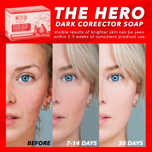 Koji White Dark Spot Corrector Soap for Face with Kojic Acid - For Exfoliating & Moisturizes Skin with Vitamin C, Niacinamide, Hyaluronic Acid, Hydrating and Uneven Skin Tone, Vegan, 3.52 Oz (2 Bars)