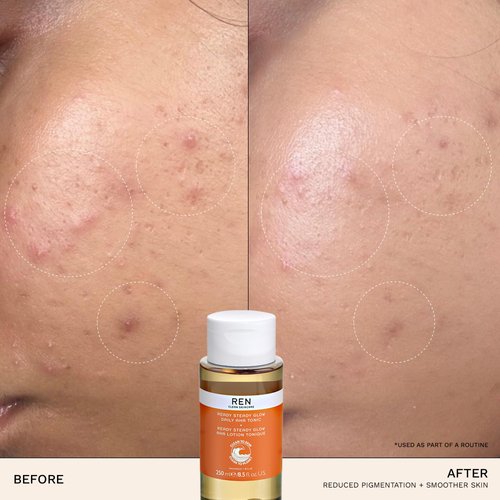 REN Clean Skincare AHA BHA Liquid Exfoliant Tonic for Face - Salicylic & Lactic Acid Exfoliator with Azelaic Acid Precursors, Radiance Exfoliating Toner