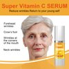Super Vitamin C Serum for Women Over 70: Advanced Anti-Aging Formula - Vitamin C, Niacinamide, Collagen, Hyaluronic Acid - Face Lift Serum for Wrinkles, Dark Spots