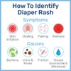 Penaten Medicated Creamy Diaper Rash Treatment, 454g