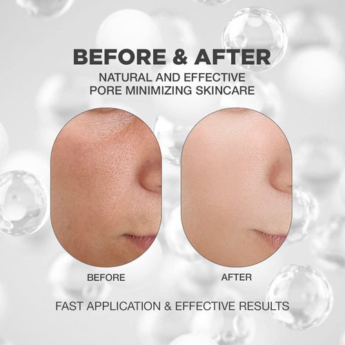 Pore Minimizer for Face | Advanced Pore Minimizer for Face | Advanced Pore Minimizer Serum for Face | Pore Minimizer Essence with High Concentrate of Hyaluronic Acid, Rosemary and Centella Asiatica | Pore Minimizer for Face with Natural and Innovative Ski