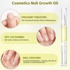 Radiant Nail Growth GIL, Radiant Nail Growth Oil Pen,Cuticle Oil for Nails,Nail Strengthener, For Moisturize Strengthen Nail Care Oil, Finger Edge Manicure Nourishing Pen, Nail Skin Edge Care(4PCS)