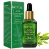 Tea Tree Acne Treatment Serum, Clear Skin Serum for Clearing Severe Acne,Breakout, Remover Pimple and Repair Skin (17ml,0.6oz)