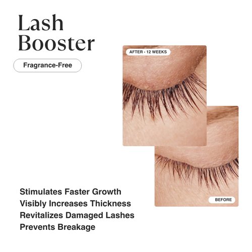 MATKAS Korean Lash Serum - Eyelash Serum To Grow Lashes Stronger, Thicker, Healthier, Unbreakable Growth, Flexible - Panthenol, Niacinamide, Allantoin, 8 Amino Acids, Vitamin E, Peptides, K Beauty 8ml