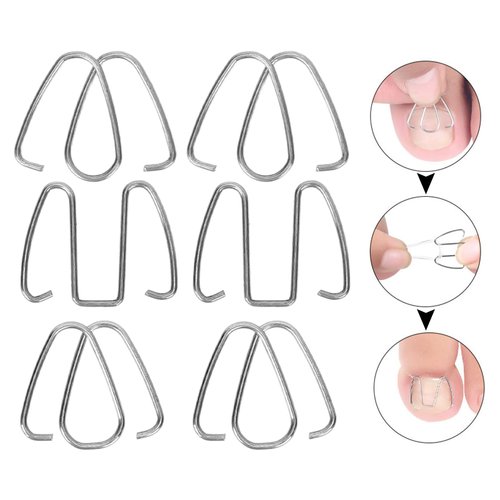 Ingrown Toe Wire Fixer, Nail Corrector Ingrown Tool Brace for Nail Toe Straighteners Braces Foot Care Men Women