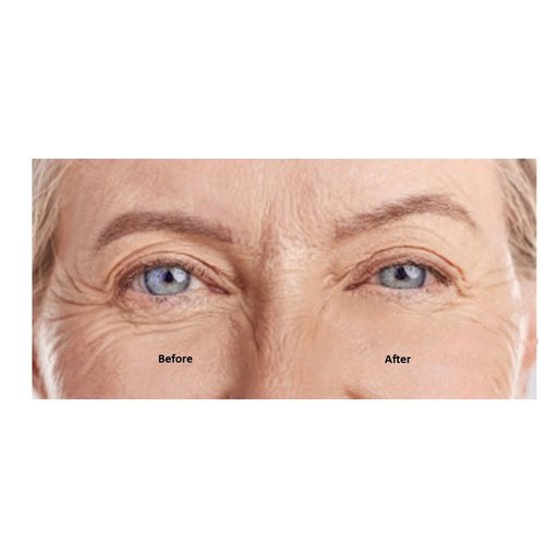 GreatProductz Miracle Instant Eye Lift Eye Cream Anti-Wrinkle