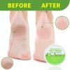DELICATESSE Foot Cream Urea Cream for Dry Cracked Heels | Urea Foot Cream For Dry, Cracked Feet, Heals And Moisturizes for Healthy Feet | Foot Dead Skin Cuticle Callus Remover Cream Feet Repair