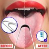 Stainless Steel Tongue Cleaner, Set of 2 for Bad Breath Treatment - Surgical Grade
