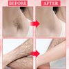 Cooling Gel for Hair Removal,Facial Gel Clear Coupling and Cooling Gel Use with Laser Hair Removal Device and Facial Body Skin Care Machine for Women & Men