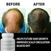 Finanutride Natural DHT Blocker & Hair Growth Capsules - Prevent Hair Loss, Stimulate Follicles, Proprietary Regrowth Treatment