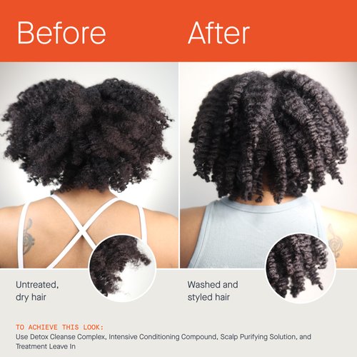 Clarifying Detox Shampoo - Removes Dirt, Oil, Product & Hard Water - Scalp Build Up Remover - Glycolic Acid & Salicylic Acid Scalp Treatment - Silicone Free 4C Hair Products for Textured, Curly Hair