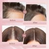 Hair Growth Serum Hair Loss Treatment for Women and Men - GRO Hair Serum for Thining Hair - Fuller Thicker and Healthier Hair, 1 Fl Oz