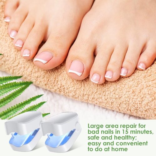 SUNCKY 2 Pack Nail Fungus Laser Treatment Device, FSA or HSA eligible Laser Fungus Nail Treatment for Toenail and Fingernail, Blue Light Therapy for Onychomycosis Damaged Discolored Thick Toenail
